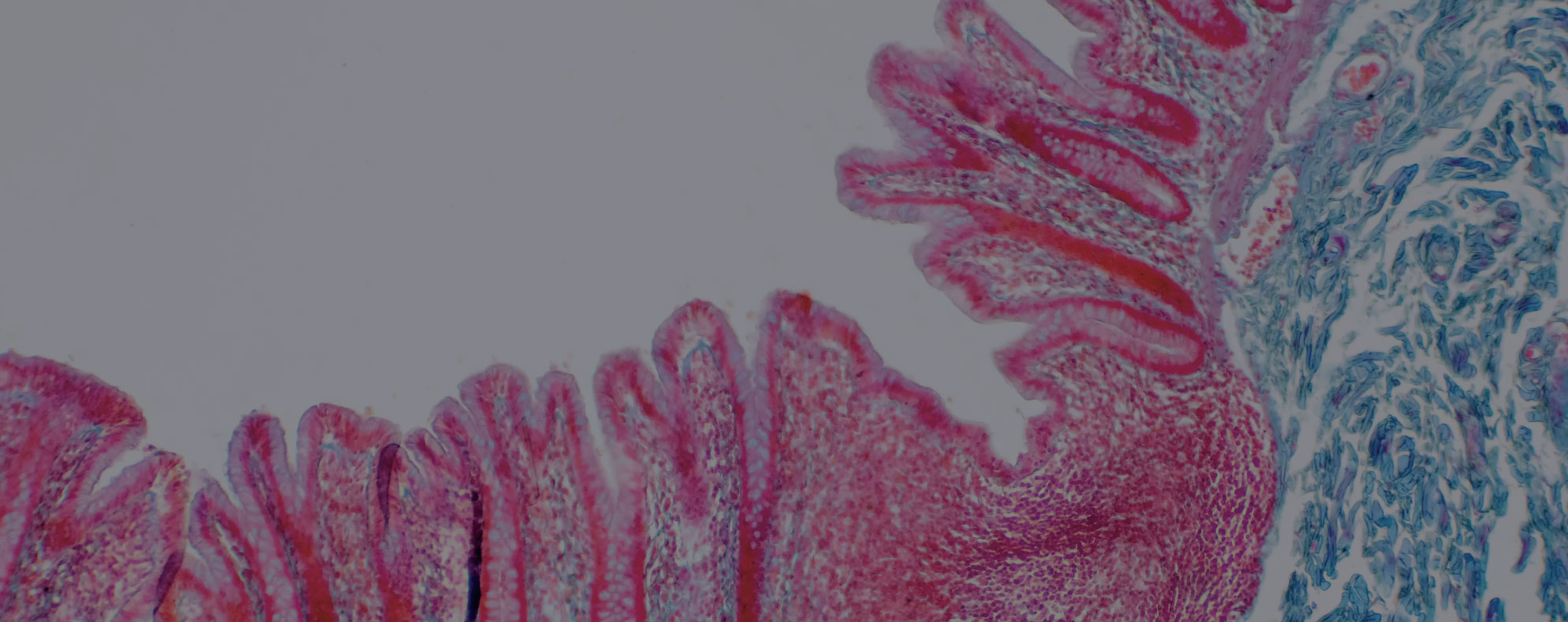 Unity Tissue RFID For Ensuring Integrity For Medical Tissues and Devices